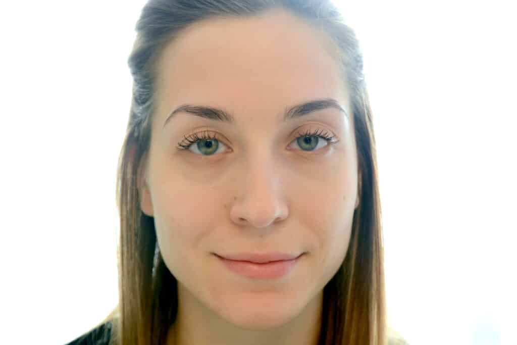 Müde Augen, Ade! - Die Thalgo Hyaluron Augenpads 6 veralice thalgo augenpads nachher1